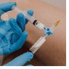 Escleroterapia com espuma