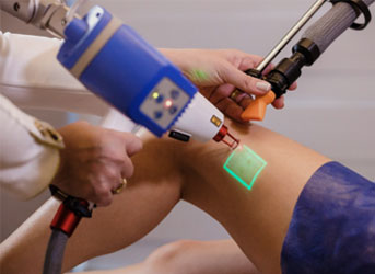 Tratamento de varizes em Curitiba - laser, espuma e clacs